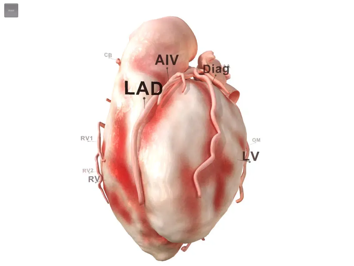 HeartVoyager iPad  스크린샷