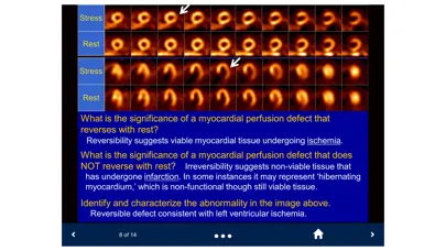 Ảnh chụp màn hình của Basic Radiology - SecondLook