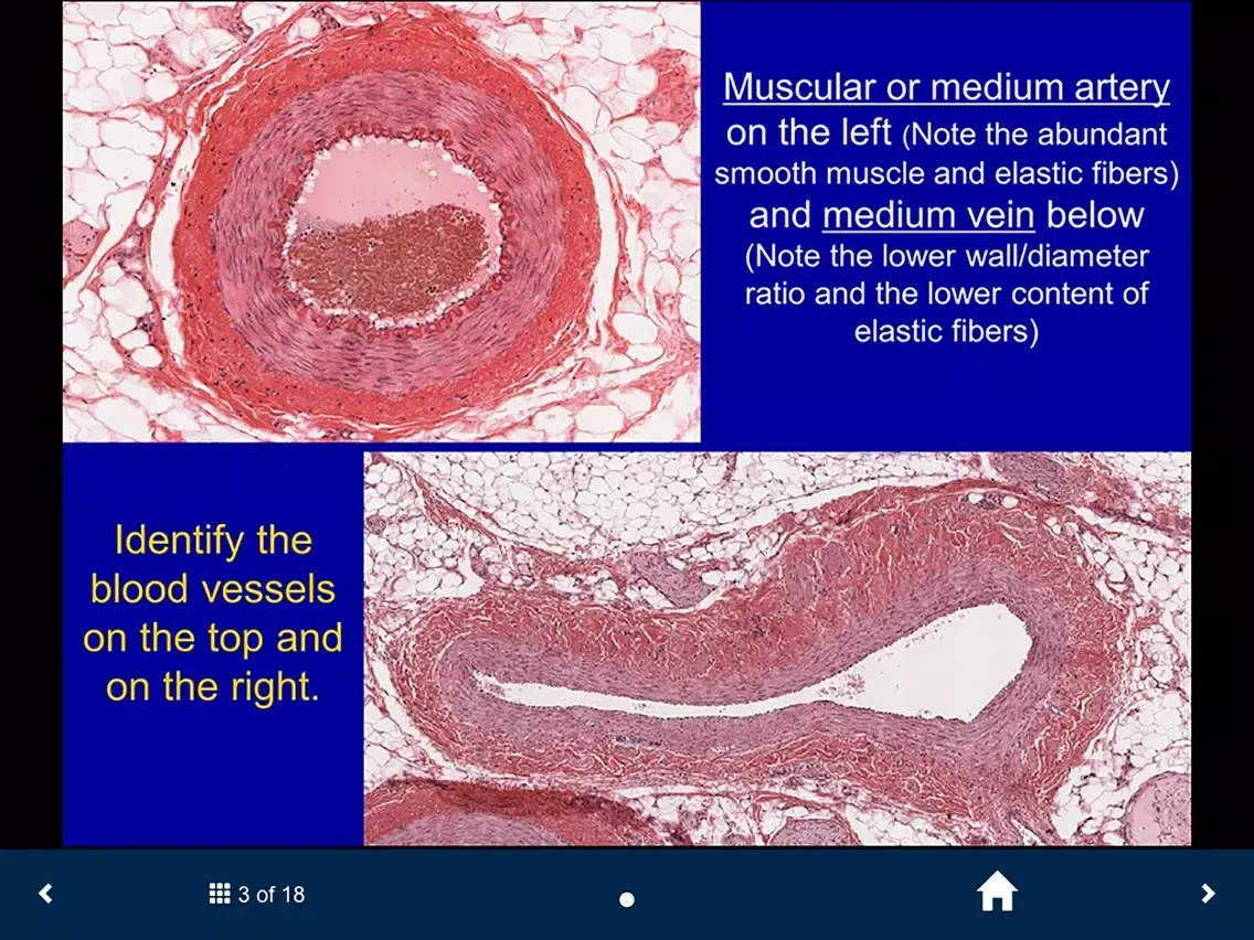 ภาพหน้าจอของ Histology - Cardiovascular and Lymphatic System iPad 