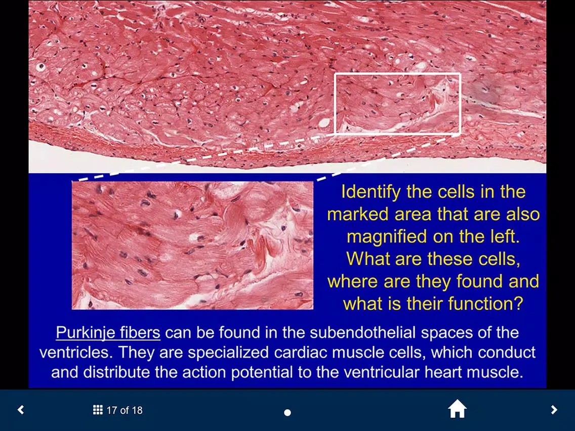 ภาพหน้าจอของ Histology - Cardiovascular and Lymphatic System iPad 