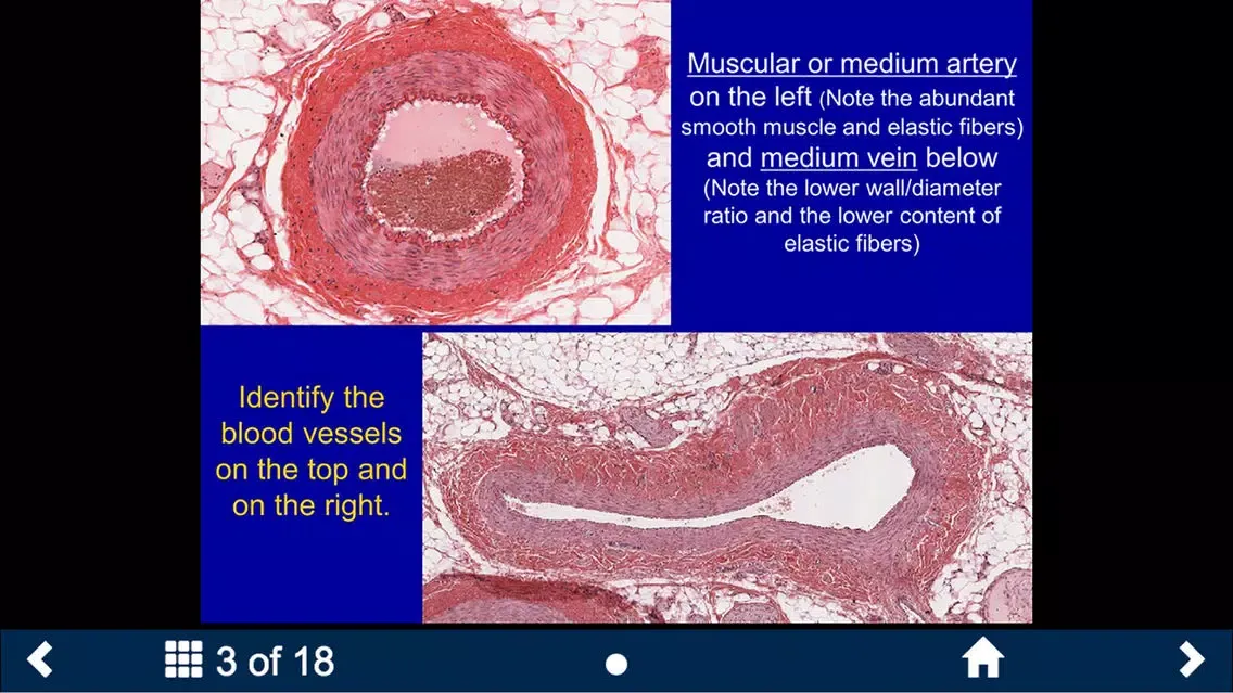 ภาพหน้าจอของ Histology - Cardiovascular and Lymphatic System