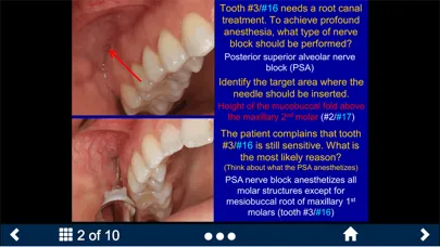 Dental Anesthesia-SecondLook Screenshots