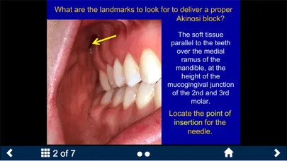Dental Anesthesia-SecondLook Screenshots