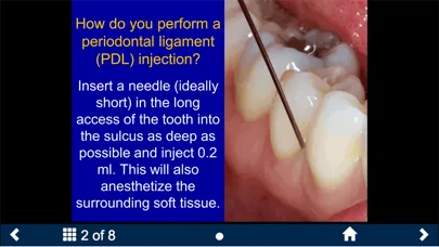 Dental Anesthesia-SecondLook Screenshots