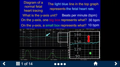 صور Fetal Heart Rate - SecondLook