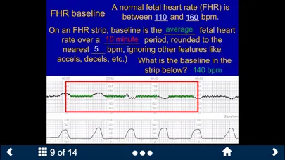 صور Fetal Heart Rate - SecondLook