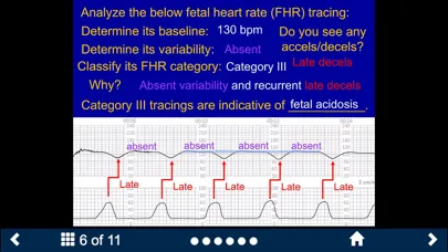 صور Fetal Heart Rate - SecondLook