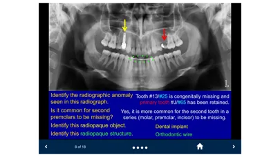 Zrzuty ekranu Oral Radiology - SecondLook