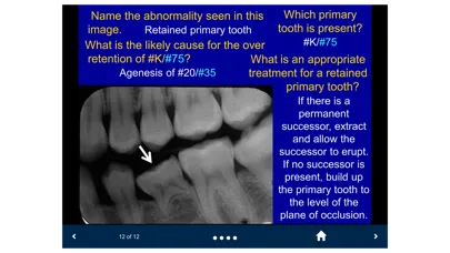 Zrzuty ekranu Oral Radiology - SecondLook