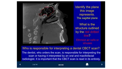 Zrzuty ekranu Oral Radiology - SecondLook