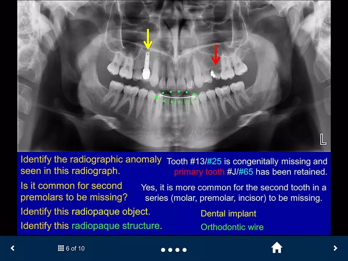 Скриншоты Oral Radiology Lite - SecondLook iPad 