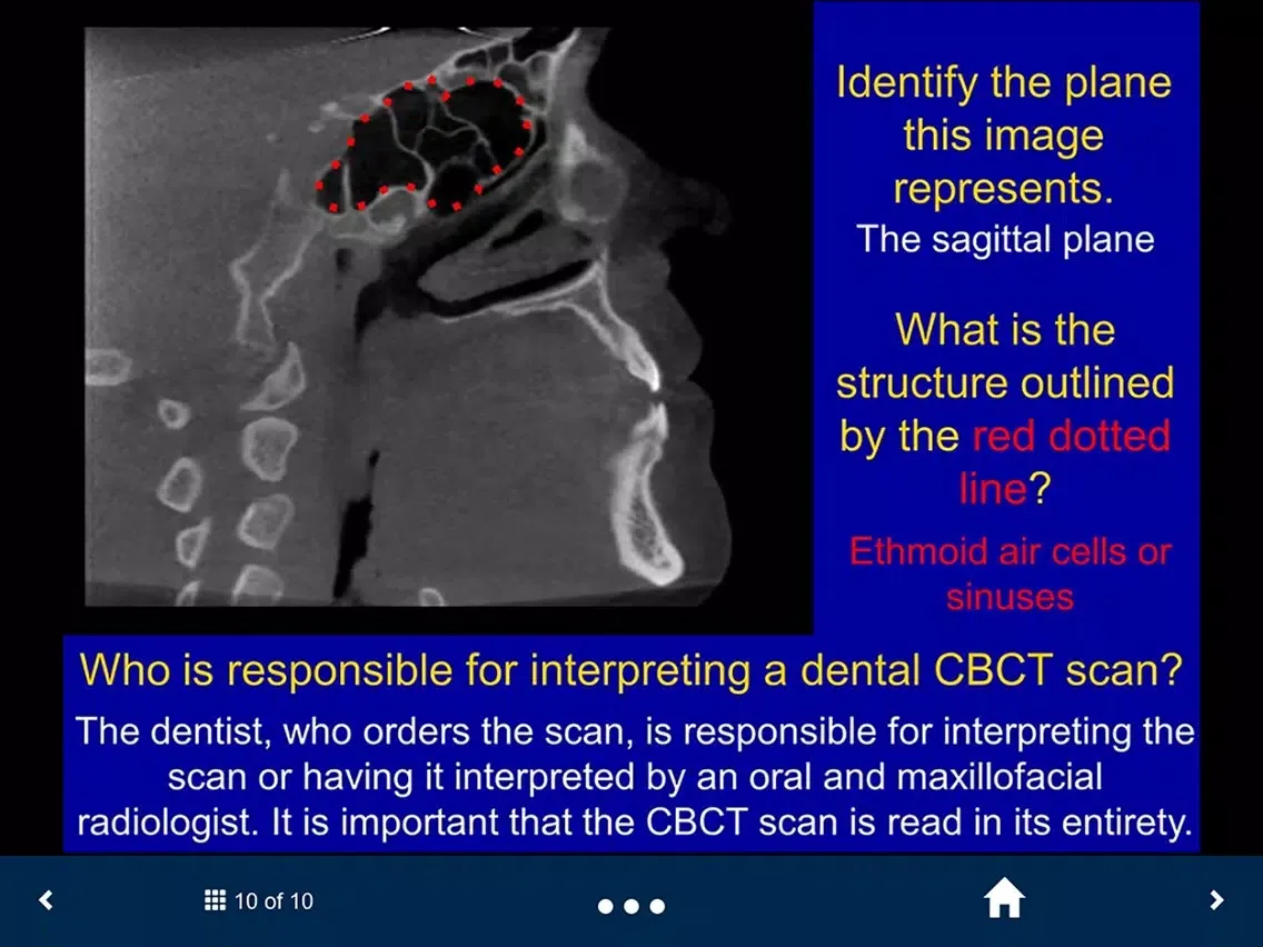 Скриншоты Oral Radiology Lite - SecondLook iPad 