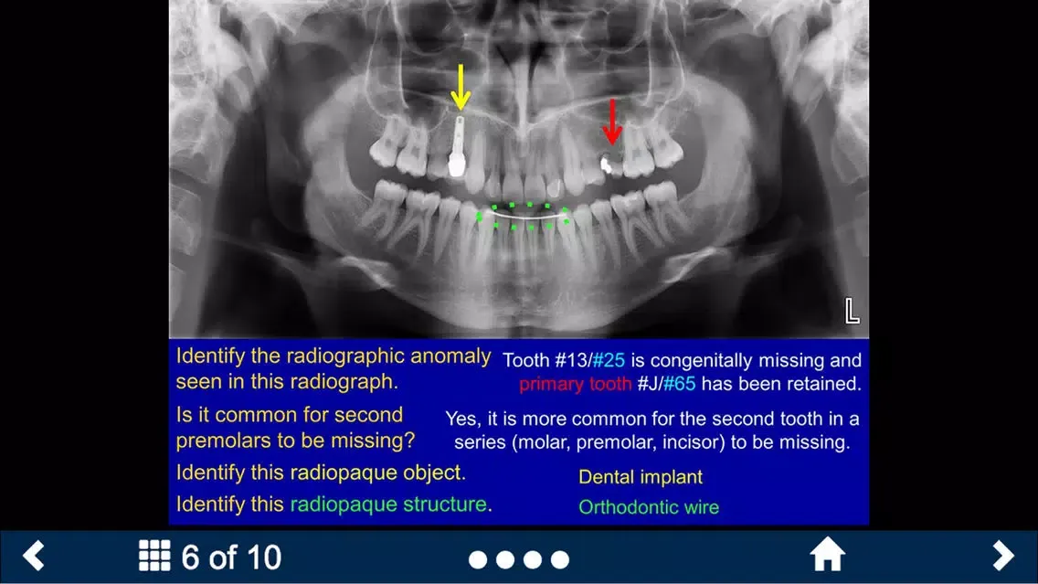 Скриншоты Oral Radiology Lite - SecondLook
