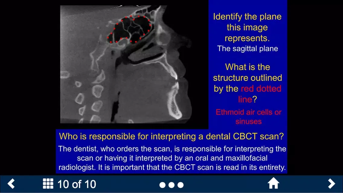 Скриншоты Oral Radiology Lite - SecondLook