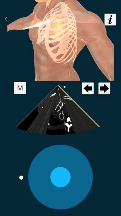 UMN TTE Screenshots