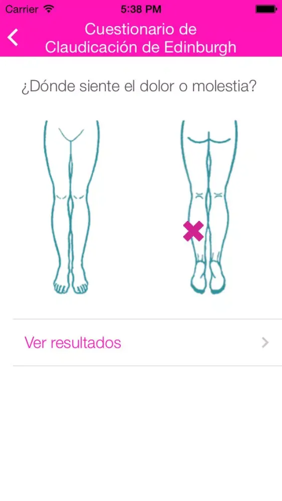 صور EAP – Enfermedad arterial periférica