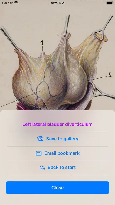 Gil Vernet’s Urology Drawings স্ক্রিনশট