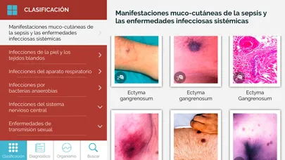 Скриншоты Dicc. Enfermedades infecciosas