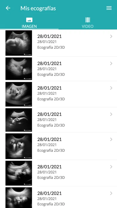 Zrzuty ekranu Mi Primera Ecografia