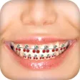 Braces Camera Photo Editor Braces Camera Photo Editor