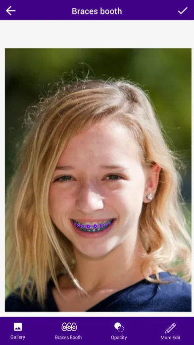 Capturas de pantalla de Braces Camera Photo Editor