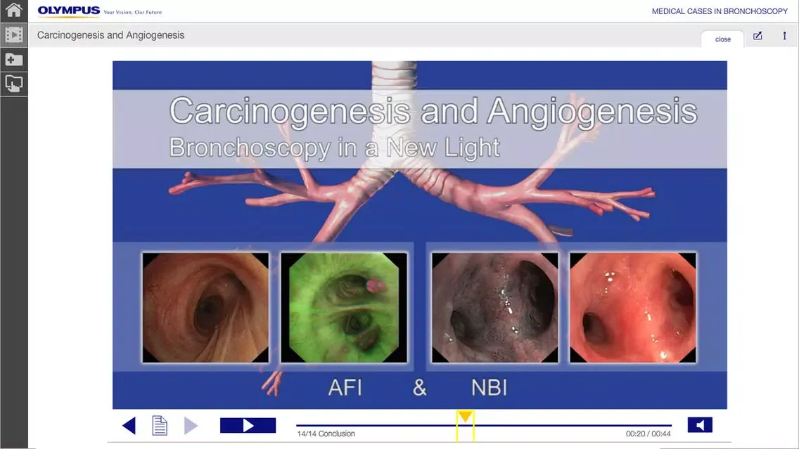 Ảnh chụp màn hình của BronchoCases