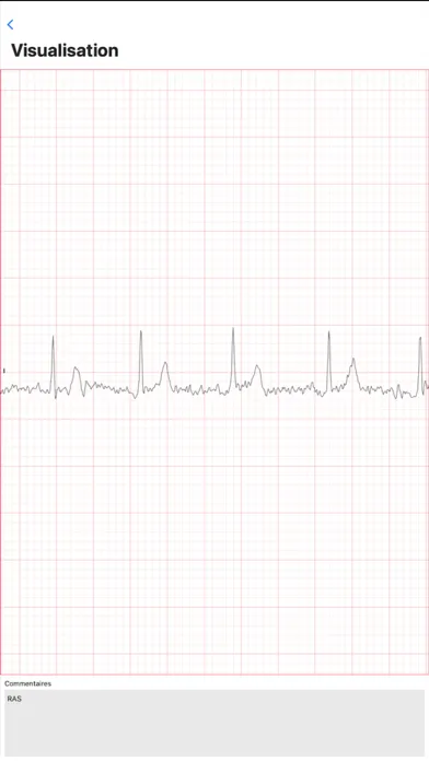 Quick-eCG Ekran Görüntüleri