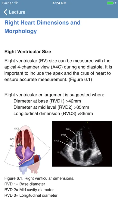 BASIC - Transthoracic Echocard سکرین شاٹس