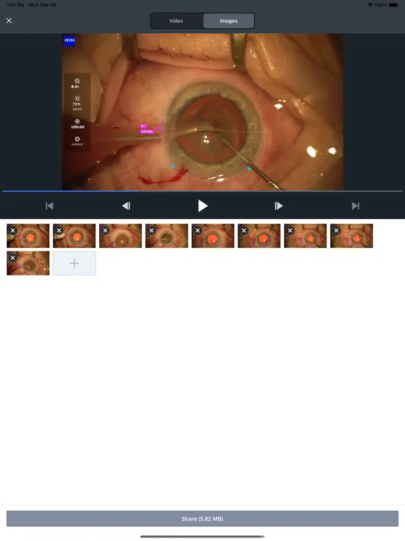 Surgery Optimizer iPad 应用截图