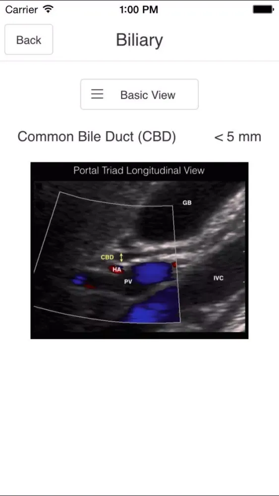 Pocket Emergency Ultrasound स्क्रीनशॉट
