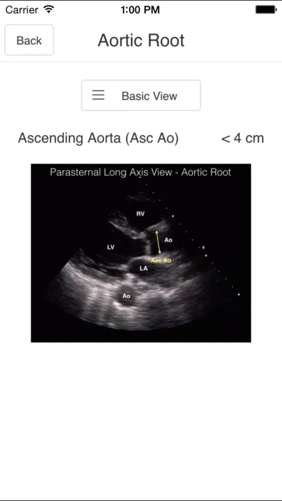 Pocket Emergency Ultrasound स्क्रीनशॉट