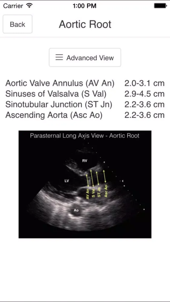 Pocket Emergency Ultrasound स्क्रीनशॉट