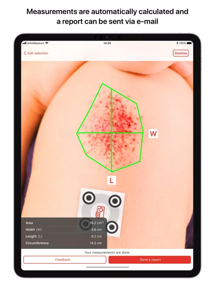 Capturas de pantalla de imitoMeasure - Measure Wounds iPad 