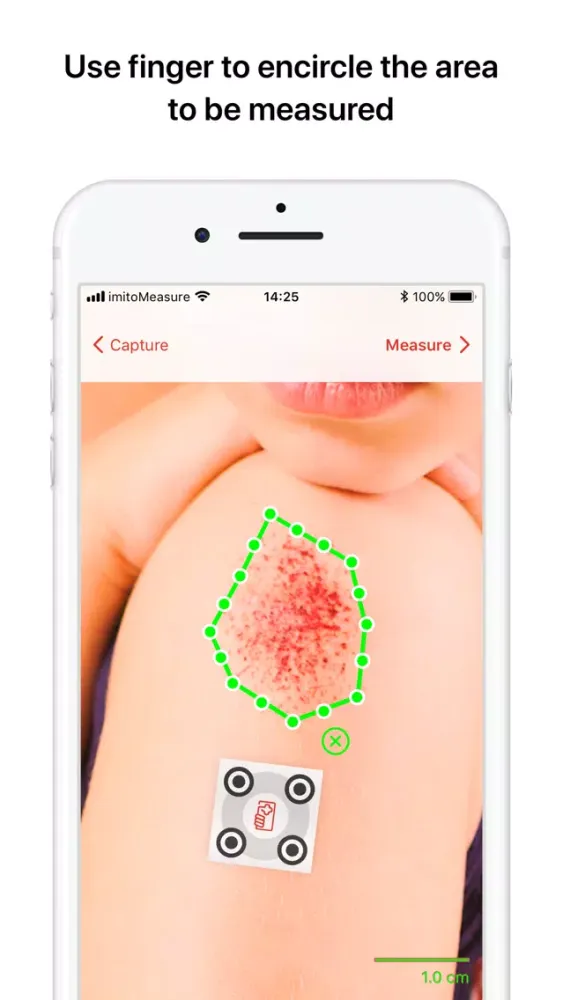 Capturas de pantalla de imitoMeasure - Measure Wounds