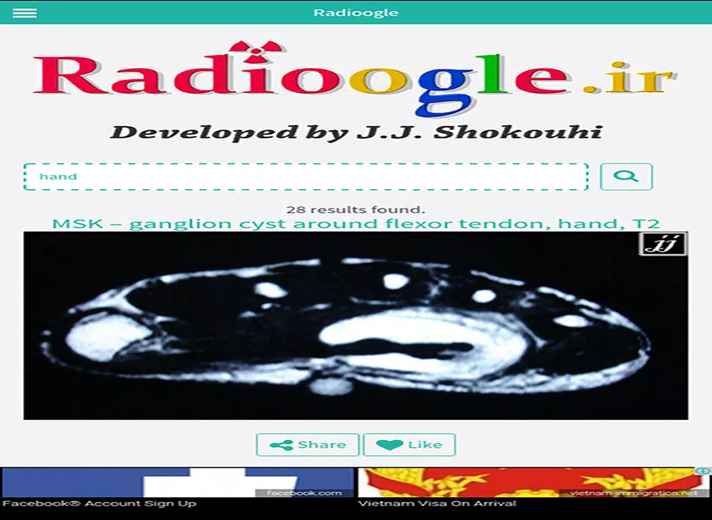Capturas de tela do radioogle iPad 