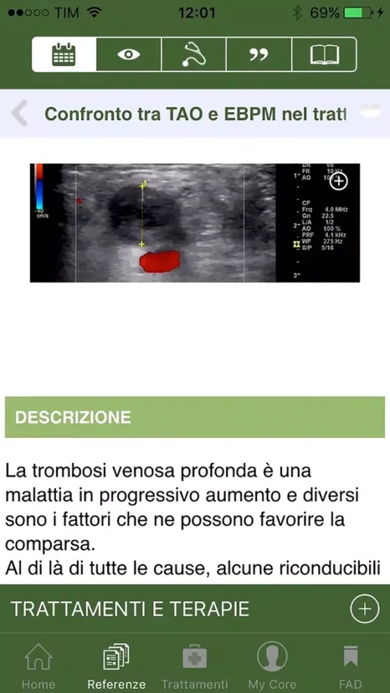 Captures d'écran de CoreMed Flebologia