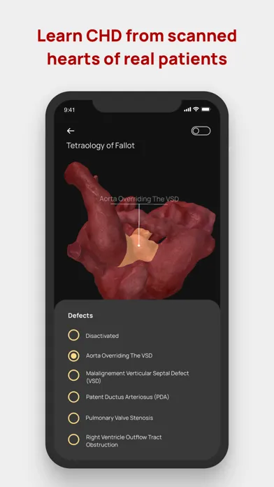 Congenital heARts Screenshots