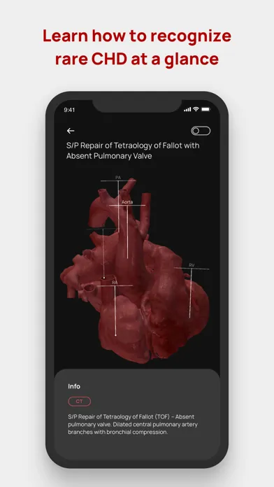 Congenital heARts Screenshots