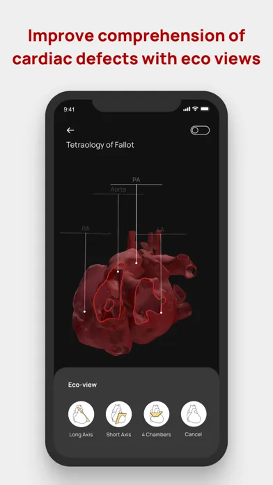 Congenital heARts Screenshots