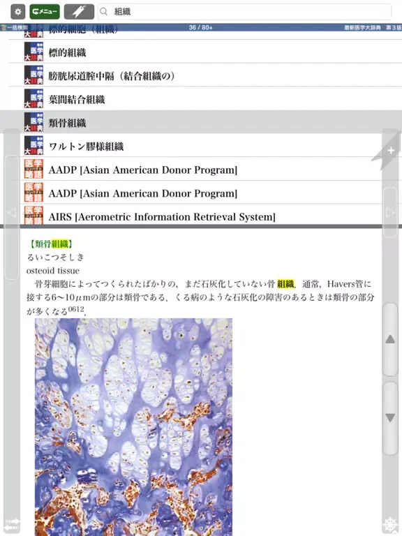 Tangkapan skrin 最新医学大辞典・医学略語統合辞書【医歯薬出版】 iPad 