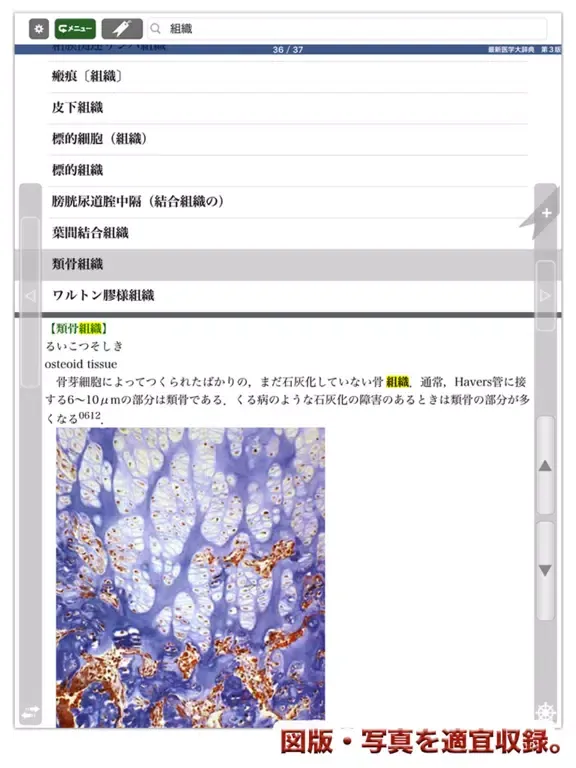 Zrzuty ekranu 最新医学大辞典第3版【医歯薬出版】(ONESWING) iPad 
