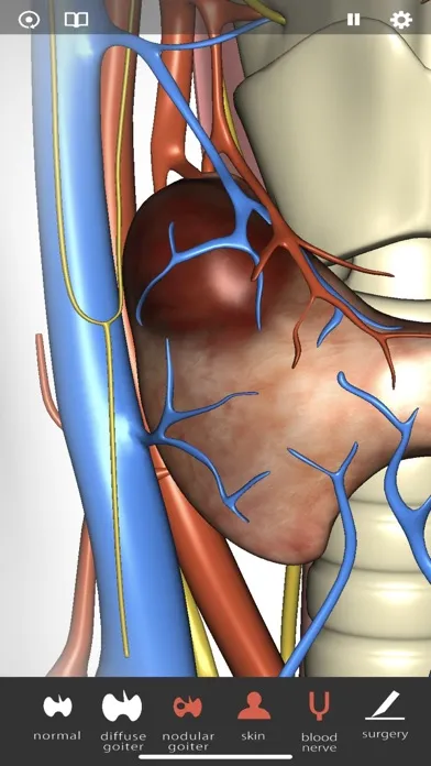 صور Thyroid Navigator