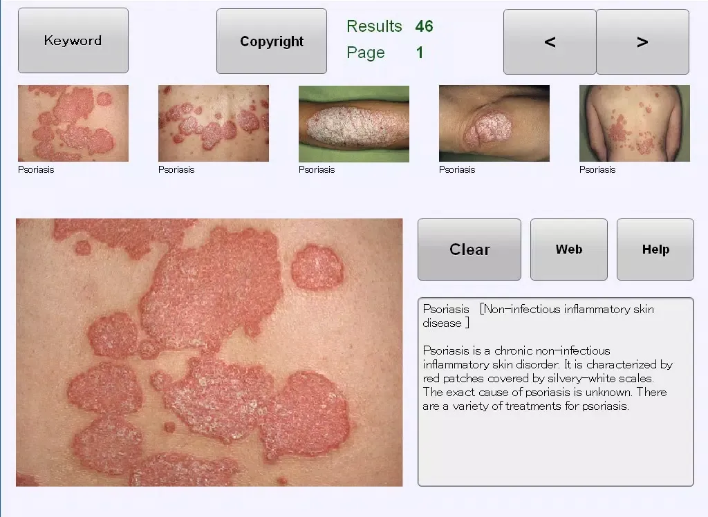 YSP Dermatology Image Database for iPhone iPad 应用截图