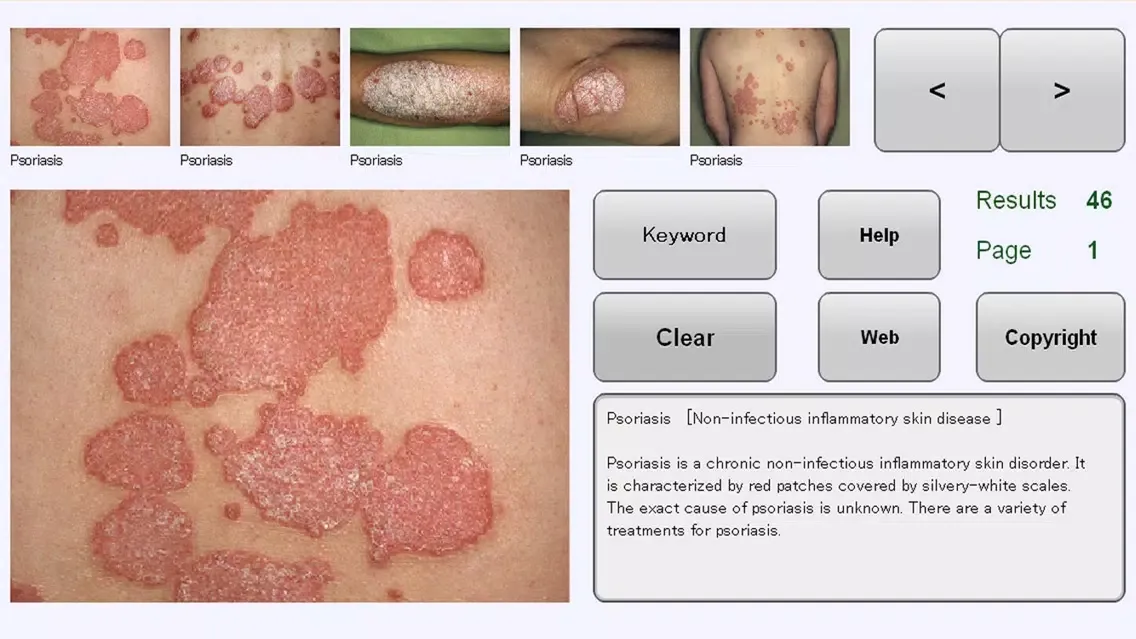 YSP Dermatology Image Database for iPhone应用截图