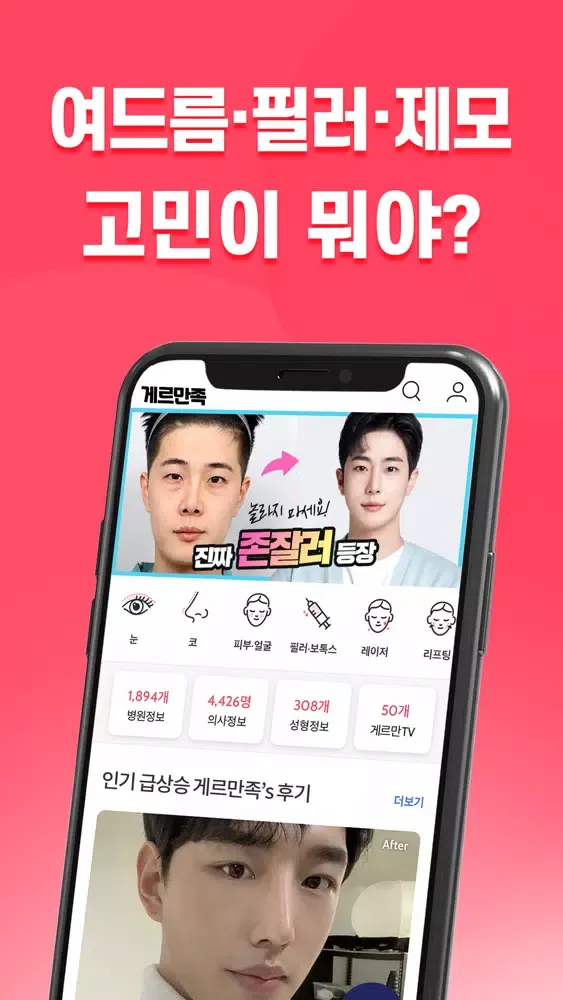 게르만족: 남자 피부·시술 정보앱 스크린샷