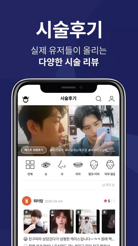 게르만족: 남자 피부·시술 정보앱 스크린샷