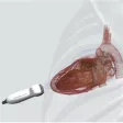 Inventive Medical Ltd Inventive Medical Ltd