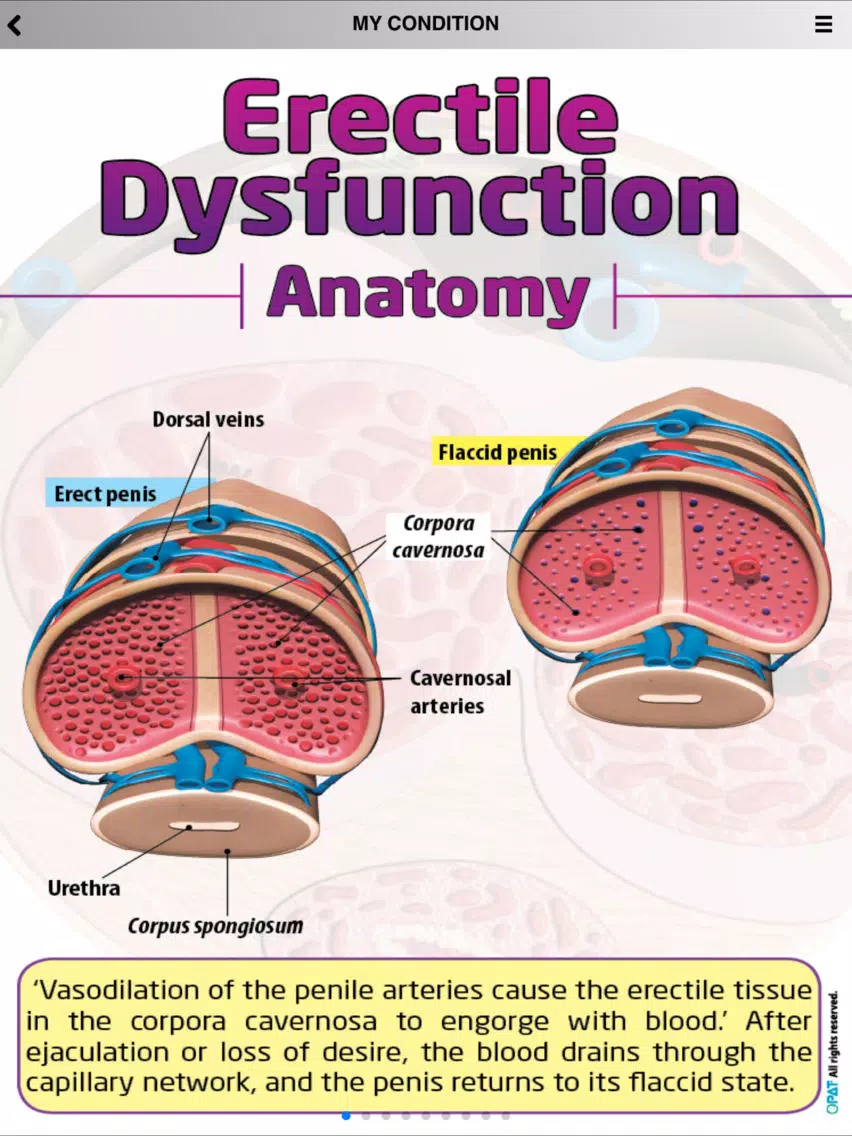 Screenshot di Manage your Erectile Dysfunction 4 iPad 
