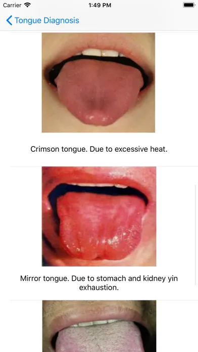 تصاویر Tongue Diagnosis