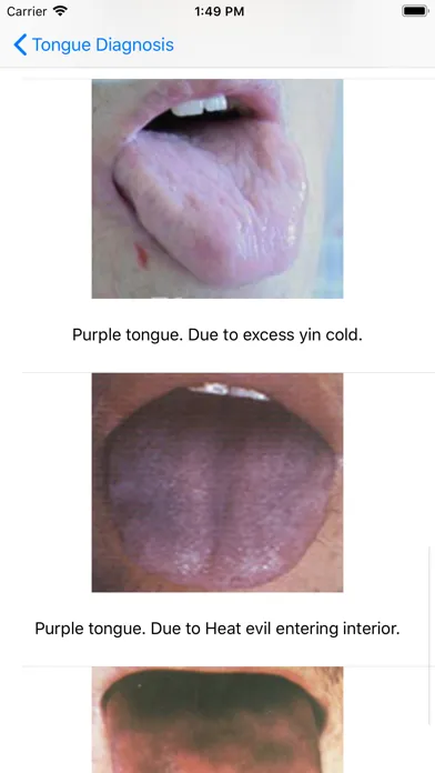 تصاویر Tongue Diagnosis